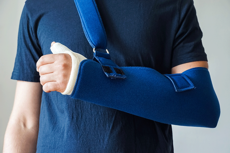 arm in cast